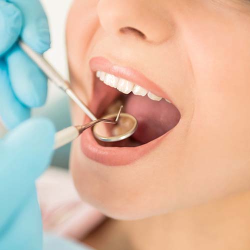 Prevenzione e Parodontologia - Dom Odontoiatria Milano